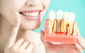 Can Dental Implants Affect Speech & Pronunciation?