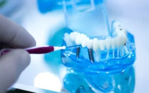 How Dental Care Can Impact Health and Confidence