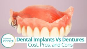 Dental implants vs. dentures: procedure & cost
